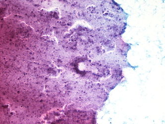 CytologicallyYoursUnknowns201310-5-05.jpg