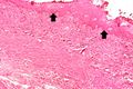 IPLab2Metaplasia5.jpg