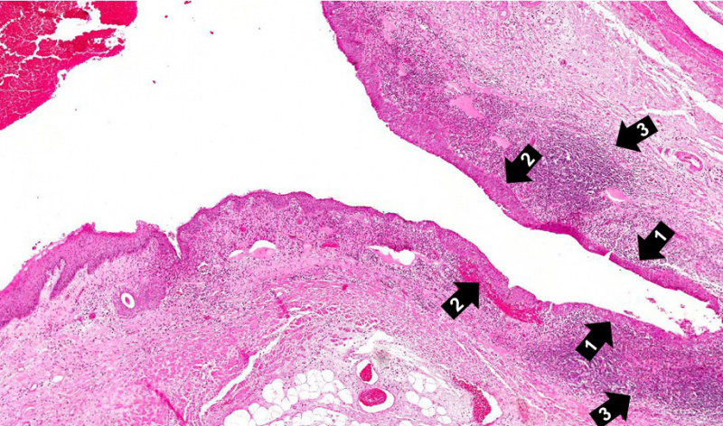 File:IPLab2Metaplasia3b.jpg