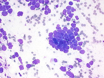 CytologicallyYoursUnknowns201310-2-06.jpg