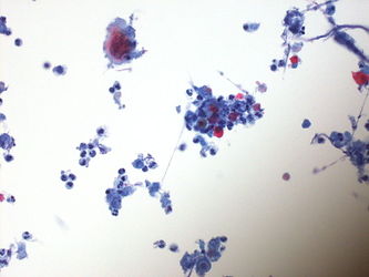 CytologicallyYoursUnknowns201310-4-05.jpg