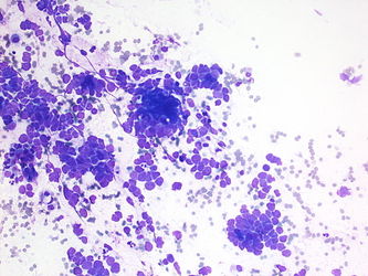 CytologicallyYoursUnknowns201310-2-05.jpg