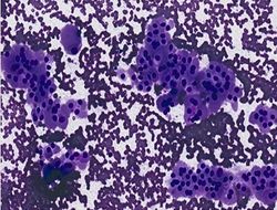 CytologicallyYoursUnknowns201311-5-03.jpg