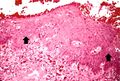 IPLab2Metaplasia6.jpg