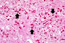 IPLab5Antitrypsin12.jpg