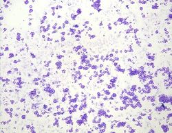 CytologicallyYoursUnknowns201311-2-01.jpg