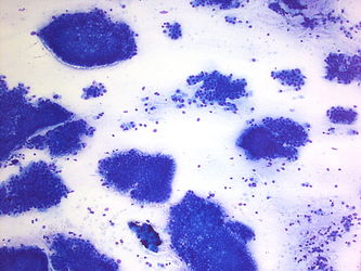 CytologicallyYoursUnknowns201401-05-03.jpg