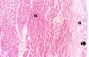 IPLab1MyocardialInfarction5.jpg