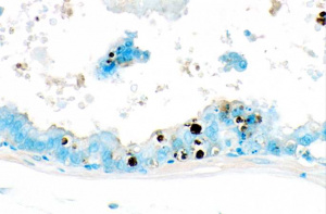 IPLab1Prostate6.jpg