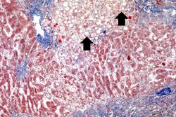 IPLab5Antitrypsin11.jpg