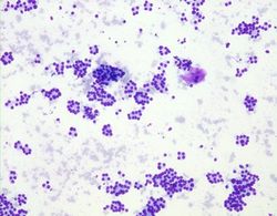 CytologicallyYoursUnknowns201311-2-02.jpg