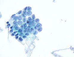 CytologicallyYoursUnknowns201311-3-03.jpg