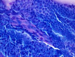 CytologicallyYoursUnknowns201312-2-04.jpg