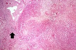 IPLab5Antitrypsin9.jpg