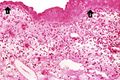 IPLab2Metaplasia3.jpg