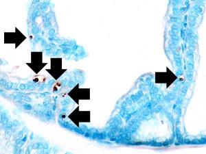 IPLab1Prostate5.jpg