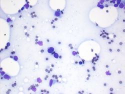 CytologicallyYoursUnknowns201312-5-04.jpg