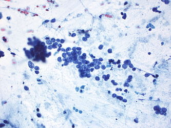 CytologicallyYoursUnknowns201310-2-07.jpg