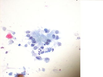 CytologicallyYoursUnknowns201310-4-04.jpg