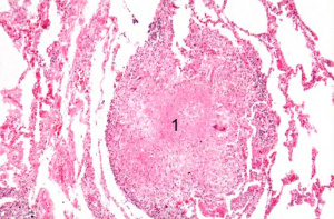 IPLab1Tuberculosis6.jpg