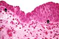 IPLab2Metaplasia4.jpg