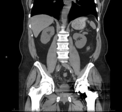 CytologicallyYoursCoW20131111Radiology1.png