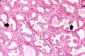 IPLab2Hyperplasia5.jpg