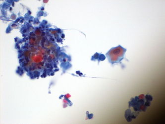 CytologicallyYoursUnknowns201310-4-06.jpg