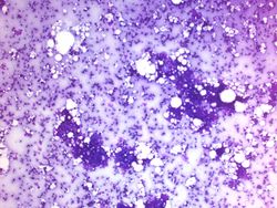 CytologicallyYoursUnknowns201312-4-01.jpg