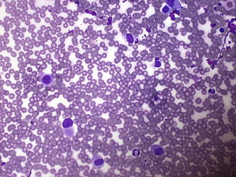 CytologicallyYoursUnknowns201310-3-03.jpg