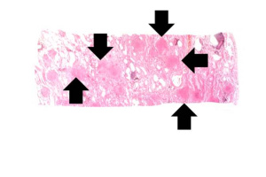 IPLab1Tuberculosis4.jpg