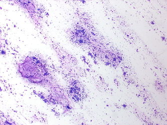 CytologicallyYoursUnknowns201310-2-01.jpg