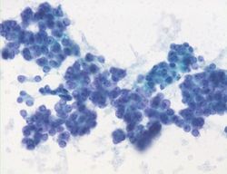 CytologicallyYoursUnknowns201311-2-03.jpg